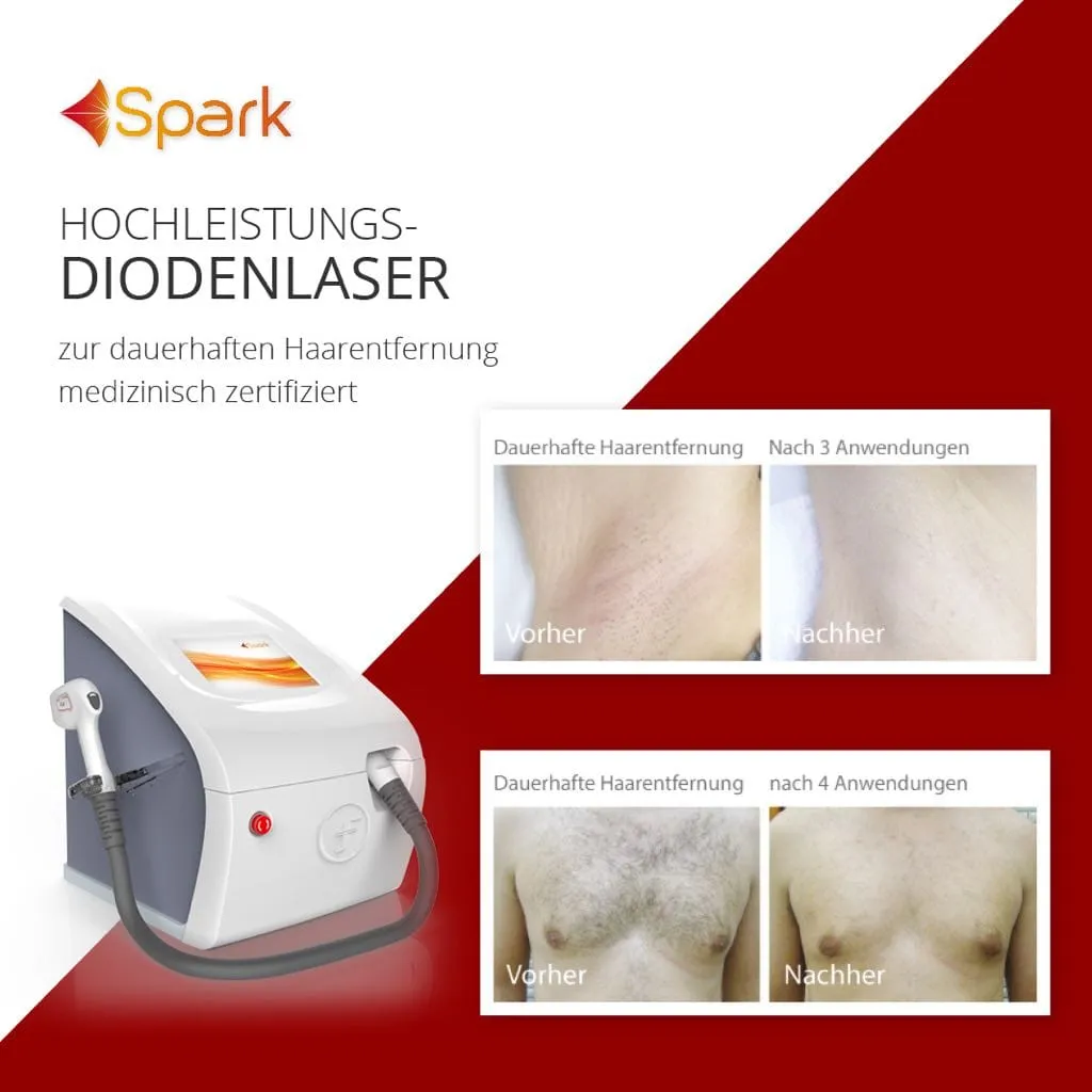 Laser-Haar-Wandel, Eindruck 2